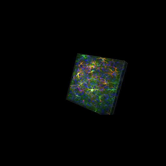 3-D reconstructed confocal image